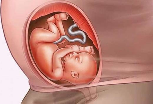 Hamilələrin məhəl qoymadığı test erkən düşük yaradır - Endokrinoloqdan XƏBƏRDARLIQ